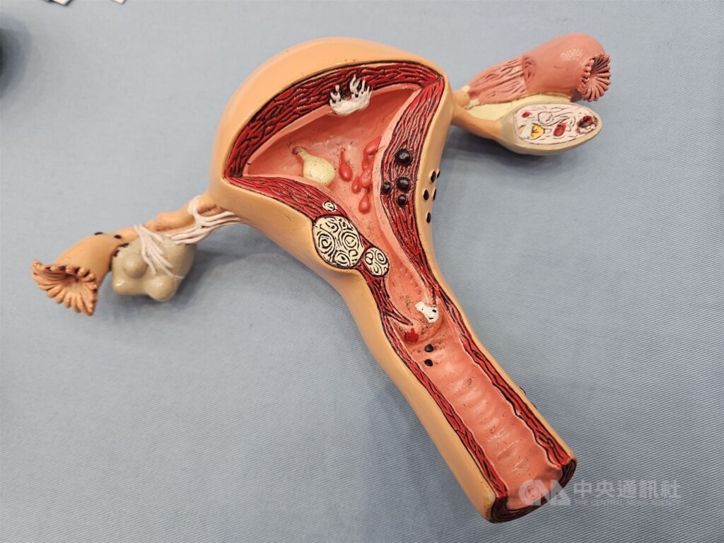 【新聞】抹片檢查非異性戀專屬　女同志勿忽視HPV風險(標題圖檔)